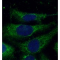 EGFR-Specific Antibody