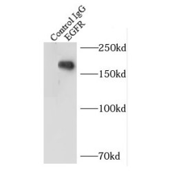 EGFR-Specific Antibody