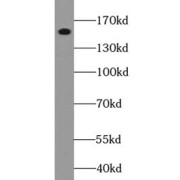 WB analysis of L02 cells, using EGFR-Specific antibody (1/2000 dilution).