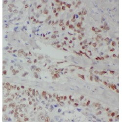 EH Domain Containing 2 (EHD2) Antibody