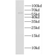 WB analysis of human heart tissue, using EHD2 antibody (1/400 dilution).