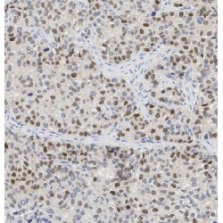 EP300-Interacting Inhibitor of Differentiation 1 (EID1) Antibody