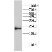 WB analysis of HepG2 cells, using EID1 antibody (1/300 dilution).