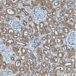 EIF2AK2, PKR Antibody