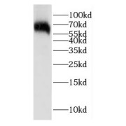 WB analysis of MCF7 cells, using EIF2AK2 antibody (1/2000 dilution).