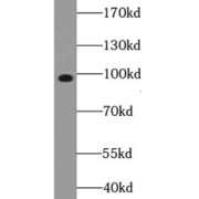 WB analysis of HeLa cells, using EIF2C1-Specific antibody (1/1000 dilution).