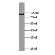 WB analysis of SKOV-3 cells, using EIF2C3-Specific antibody (1/300 dilution).