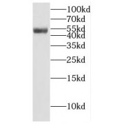 WB analysis of rat lymph tissue, using EIF3E antibody (1/100 dilution).