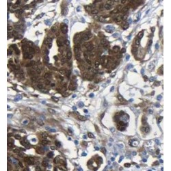 Eukaryotic Initiation Factor 4A-II (EIF4A2) Antibody