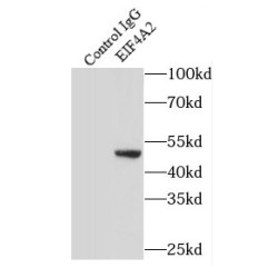 Eukaryotic Initiation Factor 4A-II (EIF4A2) Antibody