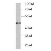 WB analysis of Jurkat cells, using EIF4A2 antibody (1/400 dilution).