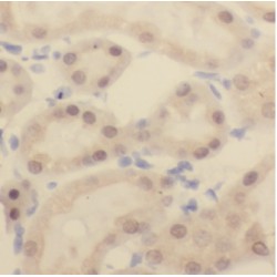 Eukaryotic Initiation Factor 4A-III (EIF4A3) Antibody