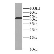 WB analysis of A549 cells, using EIF4A3 antibody (1/600 dilution).