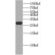 WB analysis of HeLa cells, using EIF4E2 antibody (1/500 dilution).