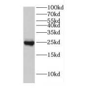 WB analysis of HeLa cells, using EIF4E3 antibody (1/500 dilution).