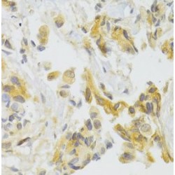 Eukaryotic Translation Initiation Factor 4 Gamma 1 (EIF4G1) Antibody