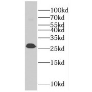 WB analysis of HeLa cells, using EIF4H antibody (1/800 dilution).