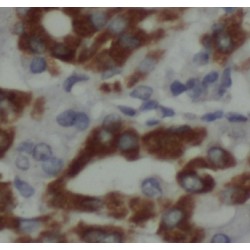 Eukaryotic Translation Initiation Factor 5 (EIF5) Antibody