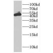 WB analysis of HeLa cells, using EIF5 antibody (1/500 dilution).