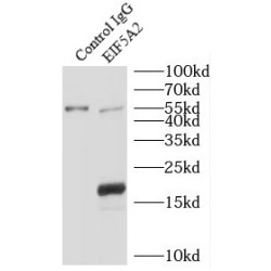 Eukaryotic Translation Initiation Factor 5A-2 (EIF5A2) Antibody