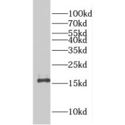 WB analysis of mouse brain tissue, using EIF5A2 antibody (1/500 dilution).