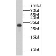 WB analysis of COLO 320 cells, using EIF6 antibody (1/1000 dilution).