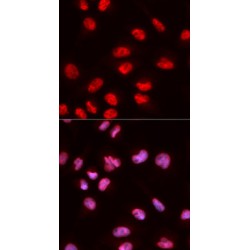 ELK1, Member Of ETS Oncogene Family (ELK1) Antibody