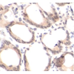 ELK1, Member Of ETS Oncogene Family (ELK1) Antibody