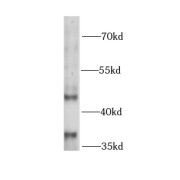 WB analysis of HeLa cells, using ELK1 antibody (1/1000 dilution).