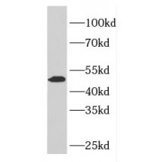 WB analysis of HeLa cells, using ELK4 antibody (1/800 dilution).