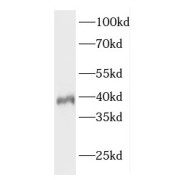 WB analysis of Y79 cells, using ELOVL4 antibody (1/500 dilution).