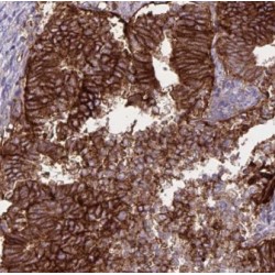 Elongator Acetyltransferase Complex Subunit 4 (ELP4) Antibody