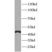 WB analysis of human cerebellum tissue, using ELP4 antibody (1/300 dilution).