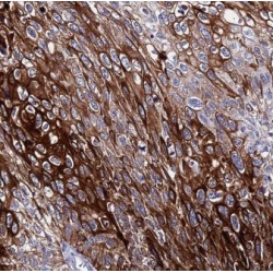 Endothelial Monocyte-Activating Polypeptide 2 (EMAP II) Antibody