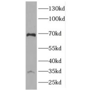 WB analysis of SGC-7901 cells, using SCYE1 antibody (1/500 dilution).