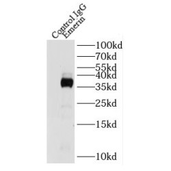 Emerin (EMD) Antibody