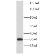 WB analysis of HeLa cells, using Emerin antibody (1/1000 dilution).