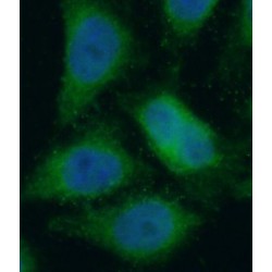 Alpha-Enolase (ENO1) Antibody