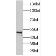 WB analysis of human skeletal muscle tissue, using ENO3 antibody (1/500 dilution).