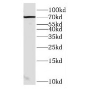 WB analysis of MCF-7 cells, using ENOX2 antibody (1/1000 dilution).