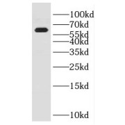 WB analysis of HL-60 cells, using ENPP4 antibody (1/1200 dilution).