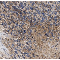 Ectonucleotide Pyrophosphatase/Phosphodiesterase 5 (ENPP5) Antibody