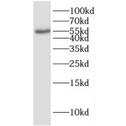 WB analysis of MCF7 cells, using ENPP5 antibody (1/300 dilution).