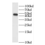 WB analysis of human brain tissue, using ENPP6 antibody (1/500 dilution).