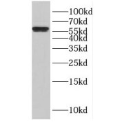 WB analysis of human brain tissue, using ENTPD3 antibody (1/500 dilution).