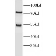 WB analysis of HepG2 cells, using ENTPD8 antibody (1/1000 dilution).