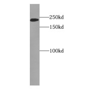 WB analysis of A431 cells, using Envoplakin antibody (1/300 dilution).