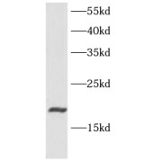 WB analysis of mouse skeletal tissue, using Eotaxin antibody (1/1000 dilution).