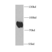 WB analysis of mouse brain tissue, using EPB41 antibody (1/1000 dilution).