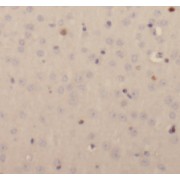 IHC-P analysis of human brain tissue, using EPB41L3 Antibody (1/200 dilution).